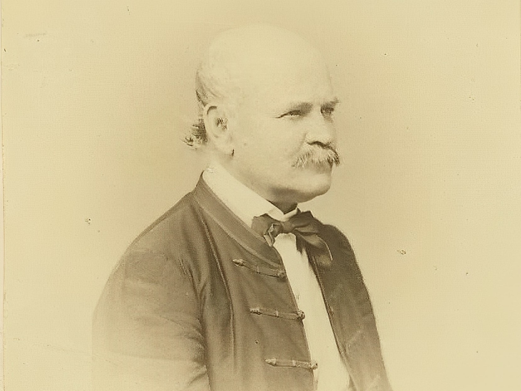 An 1860 photograph of Ignaz Semmelweis
