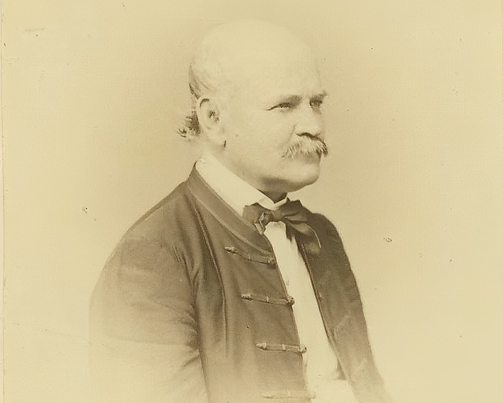 An 1860 photograph of Ignaz Semmelweis