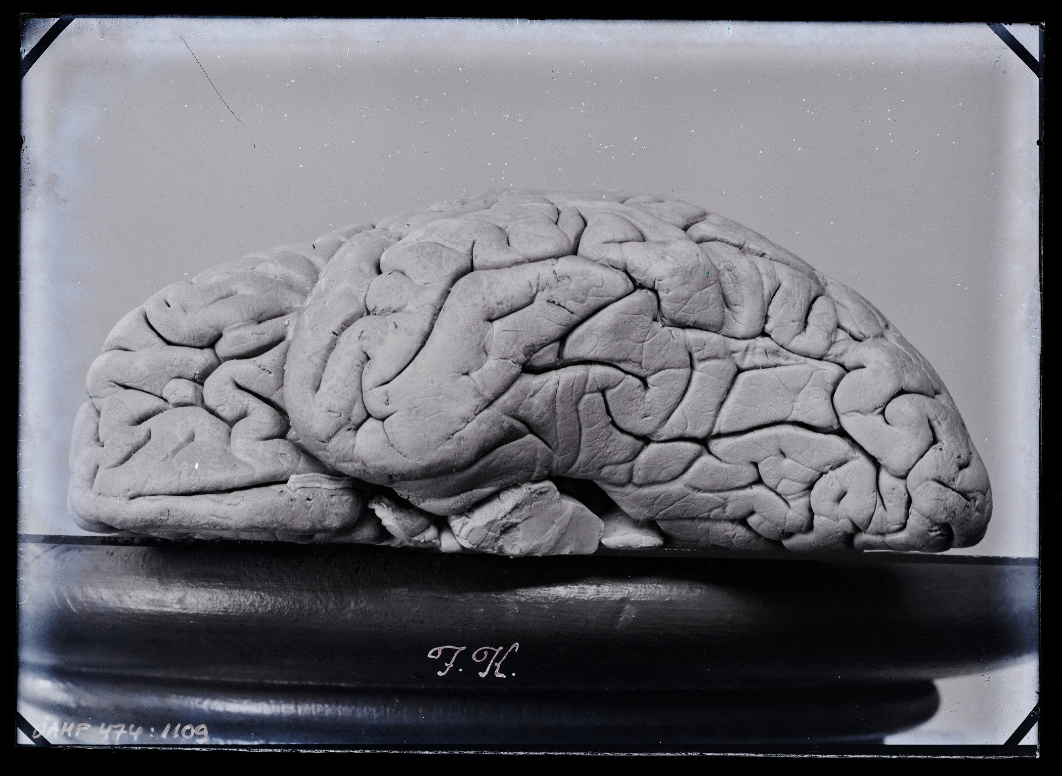 Image of the human brain